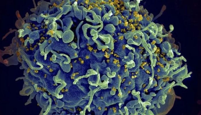 HIV: médicos anunciam 4º caso de cura